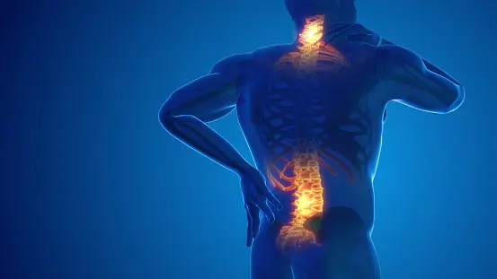 back pain radiating skeleton